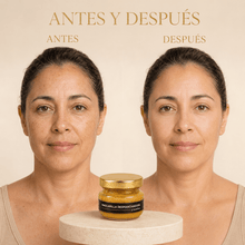 Cargar imagen en el visor de la galería, Antes y después de usar mascarilla para manchas con miel y cítricos, mostrando mejora en la piel.