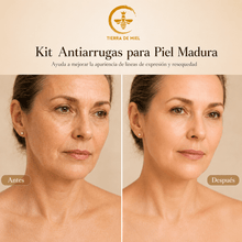 Cargar imagen en el visor de la galería, Kit Antiarrugas Para Piel Madura muestra resultados antes y después en la piel de una mujer madura.