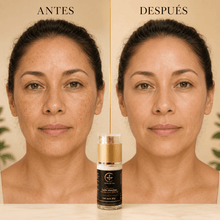 Cargar imagen en el visor de la galería, Comparativa de antes y después utilizando la crema de día para manchas con FPS 50.