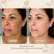 Cargar imagen en el visor de la galería, Antes y después de usar el kit quita manchas