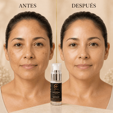 Cargar imagen en el visor de la galería, Antes y después del uso de la Crema de Noche para Manchas con Miel Melipona y Geranio, mostrando mejora en la piel.