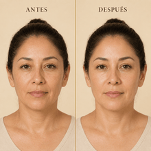 Cargar imagen en el visor de la galería, Resultados de uso del jabón facial miel vitamina E manchas, mostrando el antes y después en la piel de una mujer.