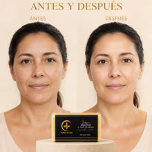 Cargar imagen en el visor de la galería, Jabón Facial de Miel y Vitamina E para Manchas
