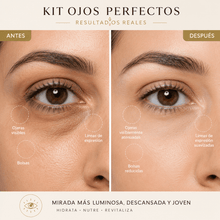Cargar imagen en el visor de la galería, Imagen del Kit Ojos Perfectos para bolsas, mostrando resultados antes y después en el contorno de los ojos.