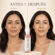 Cargar imagen en el visor de la galería, Antes y después del uso del suero facial hidratante con agua de rosas y ácido hialurónico.