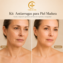 Cargar imagen en el visor de la galería, Kit Antiarrugas Para Piel Madura 40+
