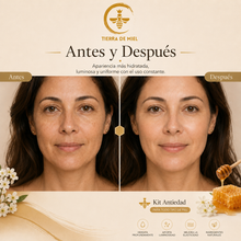 Cargar imagen en el visor de la galería, Kit Antiedad Para Todo Tipo De Piel
