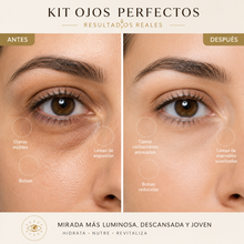 Cargar imagen en el visor de la galería, Kit  Para Quitar Ojeras y Bolsas De Los Ojos
