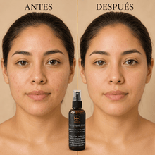 Cargar imagen en el visor de la galería, Antes y después del uso del Spray para Imperfecciones con Propóleo y Miel, mostrando resultados visibles en la piel.
